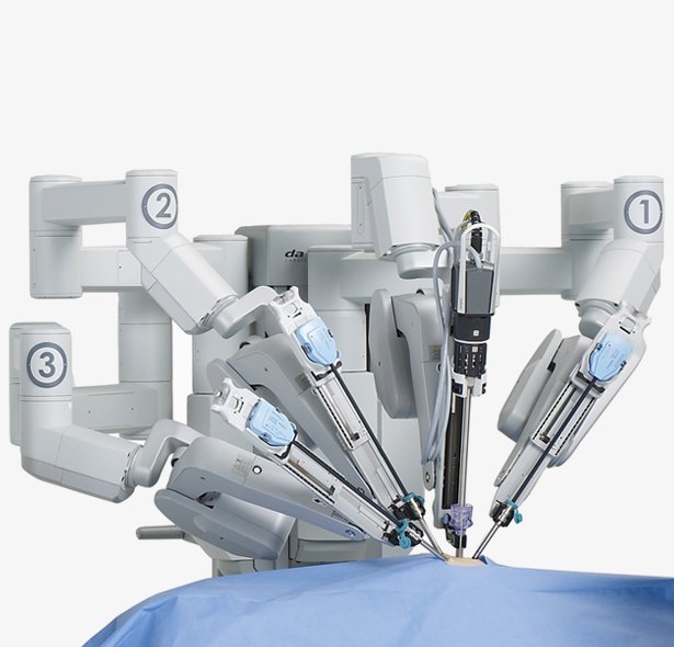 Robotic Radical Cystectomy