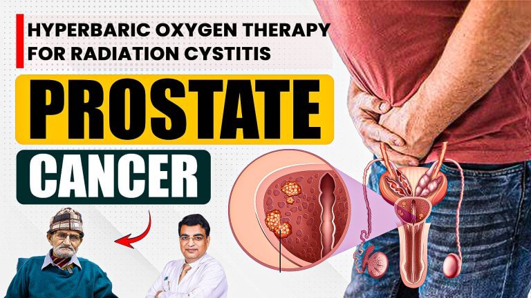 Prostate Cancer